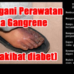 Manfaat Madu Untuk Luka Gangren